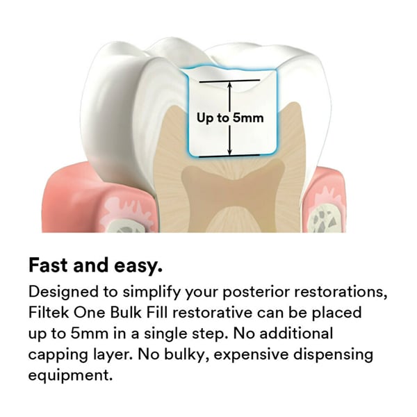 A1 Filtek One Bulk Fill Posterior Restorative Capsules A1 0.2g 20/Pk