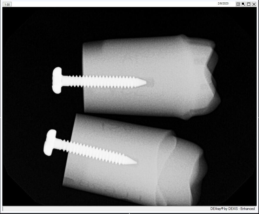 dexis platinum x-ray